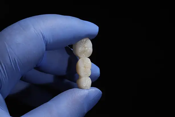 zirconia crowns