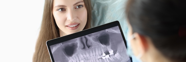 Dental X-Rays Norfolk