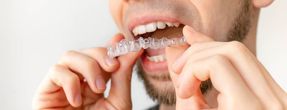 Confident patient smiling after Invisalign treatment with Platinum Provider near Hampton Coliseum Virginia