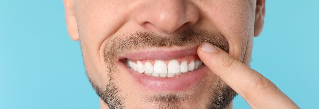 Dental Exams and Cleanings