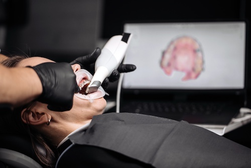 Dental Implant 3D Scan