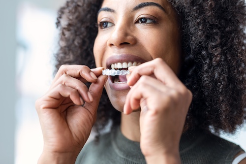Woman Putting In Invisalign