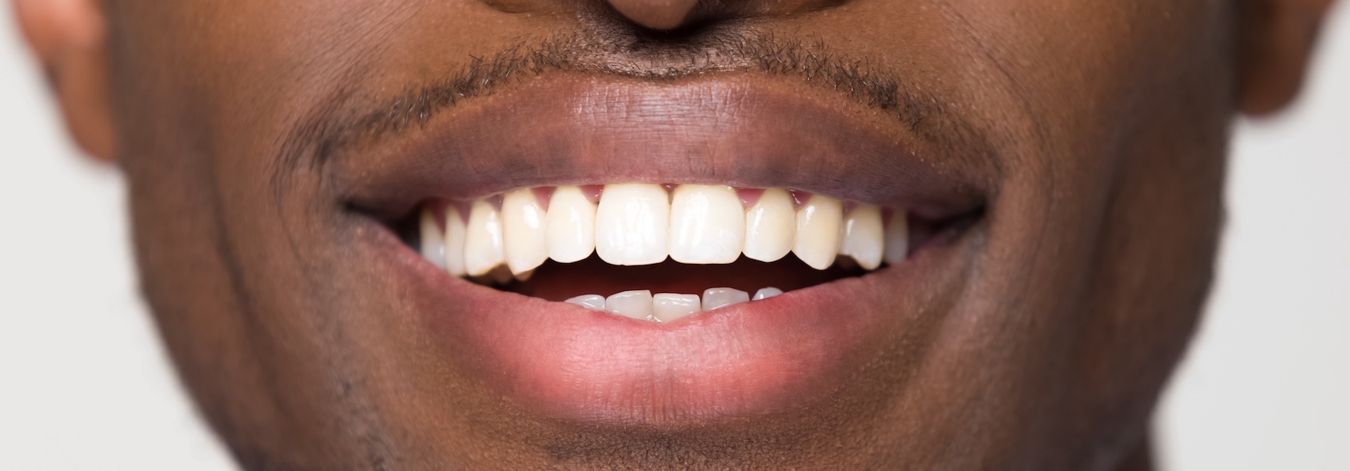 Close-up view of a beaming white, wide male smile, black man with healthy, straight, clean teeth isolated on a grey studio background.